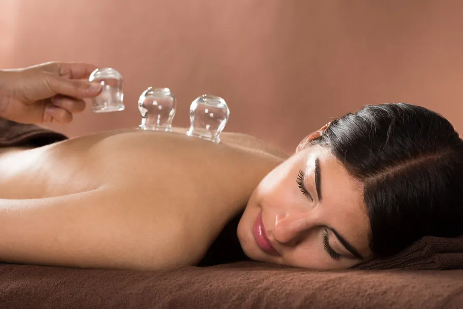 MCT cupping therapy